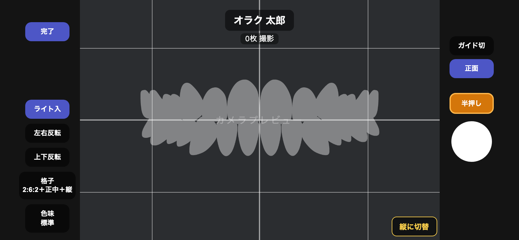 撮影画面に正面（歯列）の構図ガイドが白く薄く重なって表示され、右側のガイドボタンが「正面」でオンになっている