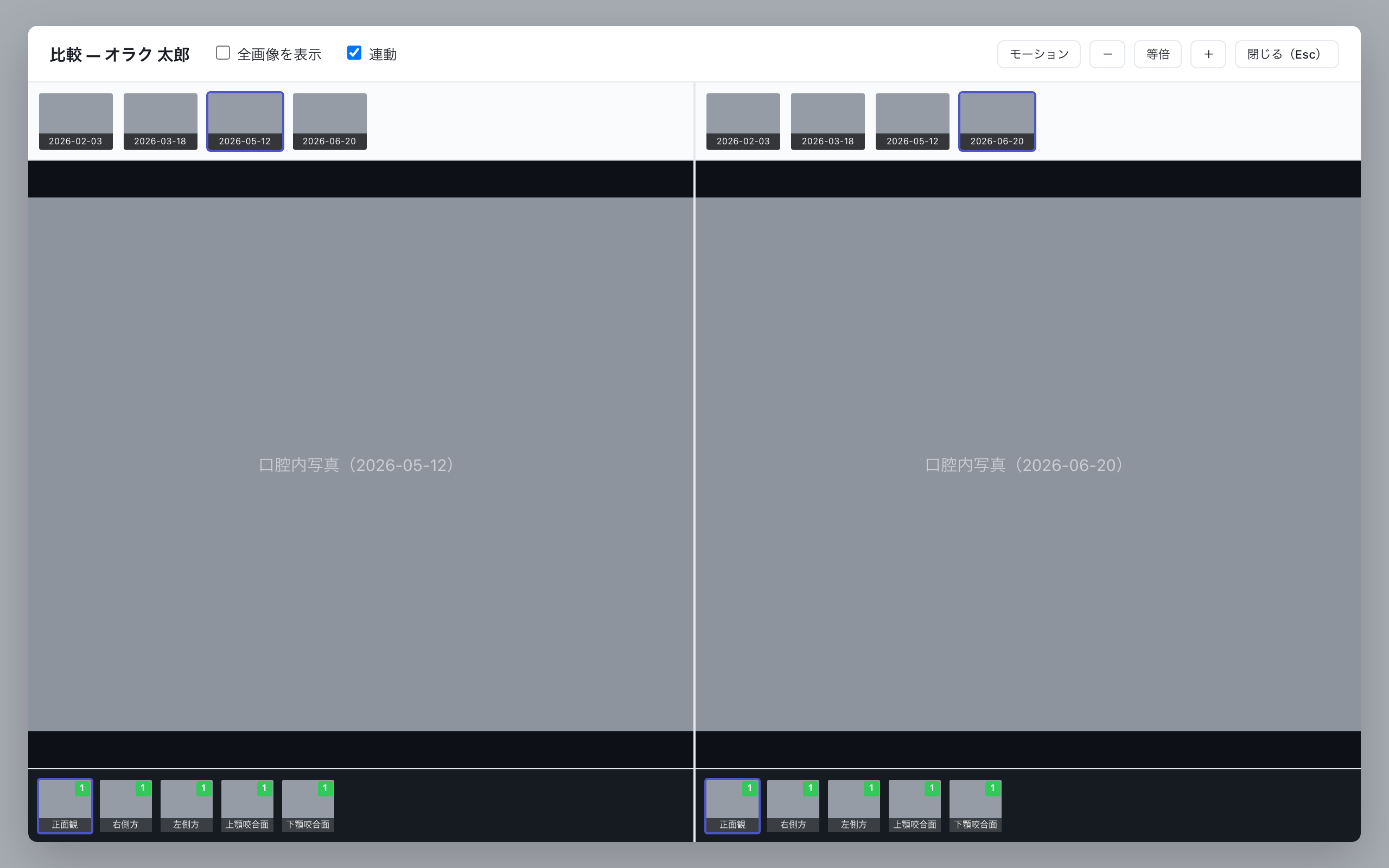 経過比較。左右2ペインで別の撮影日を表示し、上に撮影日サムネ・下に写真サムネが並ぶ